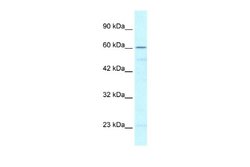 ZNF212 Antibody, Novus Biologicals 100 &mu;L; Unconjugated:Antibodies,